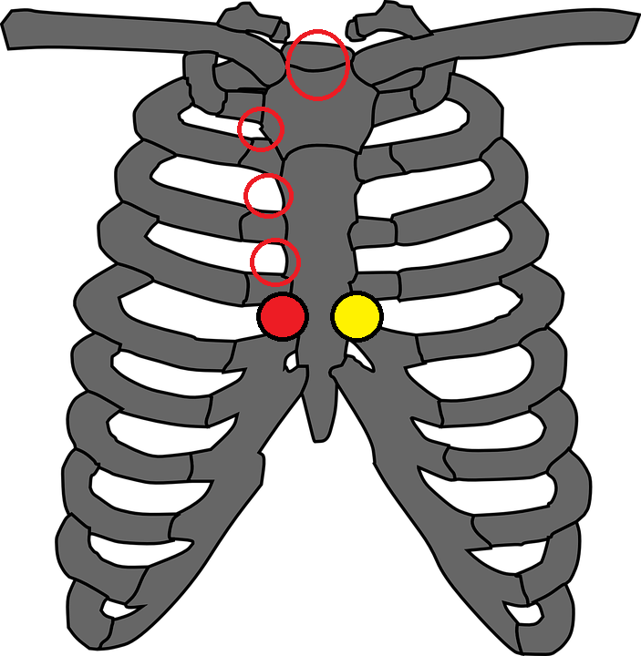 Procedura elettrocardiogramma: corretta posizione degli elettrodi ECG 1 Individuare e posizionare l'elettrodo V1 e elettrodo V2 dell'ECG .