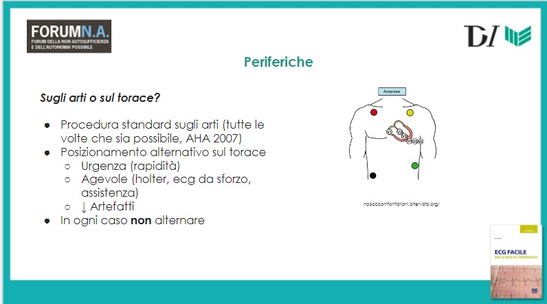 Procedura elettrocardiogramma: corretta posizione degli elettrodi ECG 6 Periferiche sugli arti o sul torace