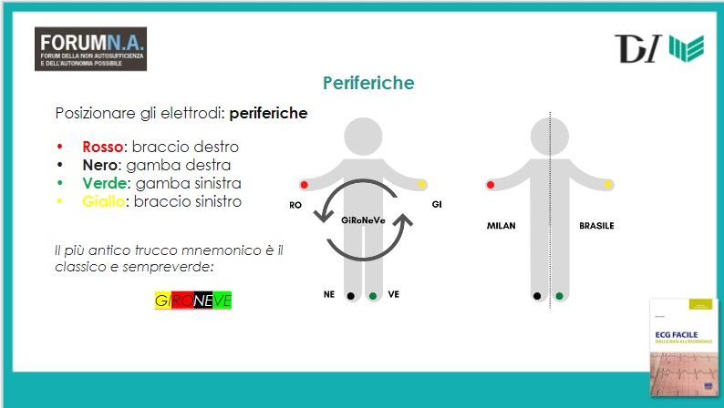 Procedura elettrocardiogramma: corretta posizione degli elettrodi ECG 5 Posizionare gli elettrodi periferici con il gironeve