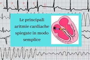 Le aritmie cardiache spiegate semplicemente in un corso che parte da zero