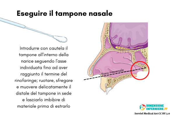 Come eseguire il tampone nasale Serviel Medical Art CC BY 3.0