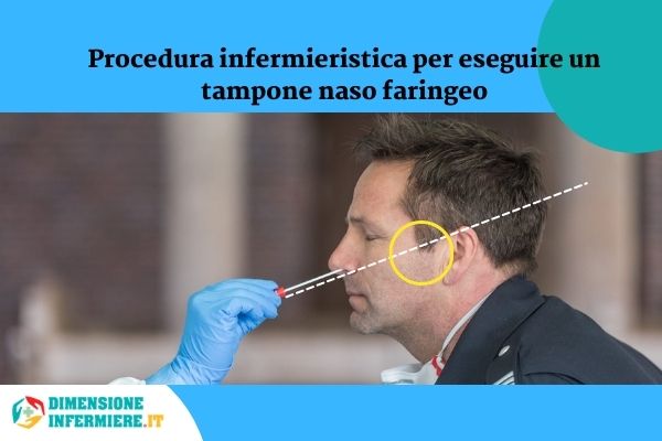 Procedura infermieristica per eseguire un tampone naso faringeo Modificato da Raimond Spekking Wikimedia Commons Procedura infermieristica per eseguire un tampone naso faringeo Modificato da Raimond Spekking Wikimedia Commons