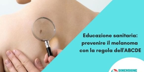 Educazione sanitaria prevenire il melanoma con la regola dell'ABCDE