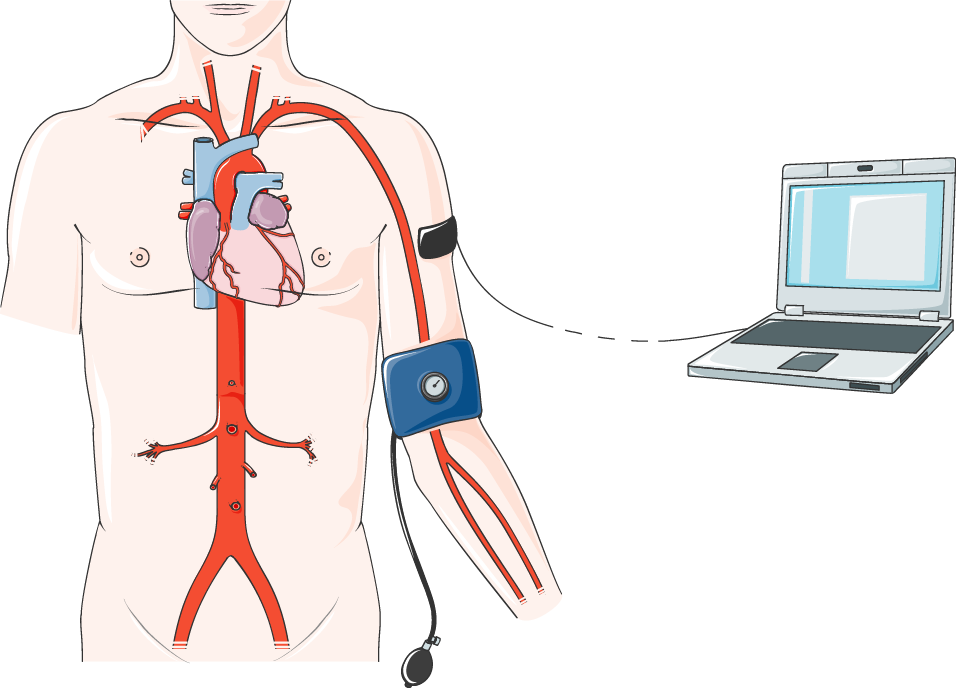 Come misurare la pressione arteriosa - Servier Medical Art - CC BY 3.0
