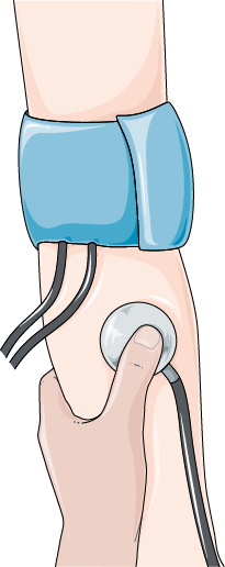 Come misurare la pressione arteriosa con lo sfigmomanometro - Servier Medical Art - CC BY 3.0