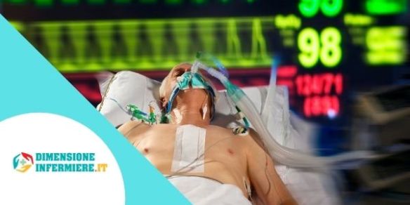 Shock guida completa alla gestione medico-infermieristica del paziente
