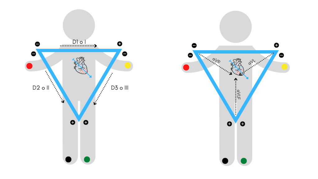 Triangolo di Einthoven. Dario Tobruk © realizzato con Canva.com versione Pro