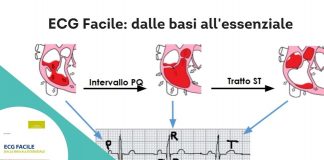 “ECG facile” il manuale per imparare a interpretare l’elettrocardiogramma