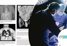 Un raro caso di pneumoscroto Immagini tratte da American Journal of Case Reports e Canva Pro.