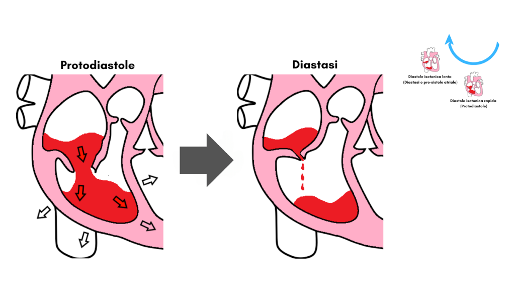 Ciclo cardiaco riassunto, completo e schematizzato con grafici 7 Protodiastole e diastasi Tratto da Ecocardio Facile di Dario Tobruk ed Maggioli 2024