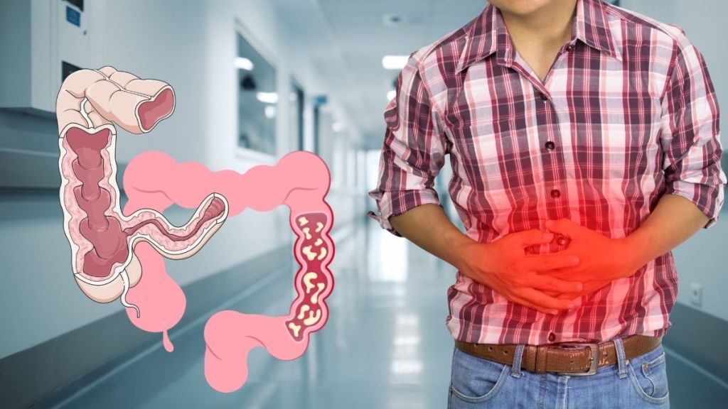 Uomo con dolore addominale associato a malattia infiammatoria cronico intestinale, con illustrazione medica del colon infiammato
