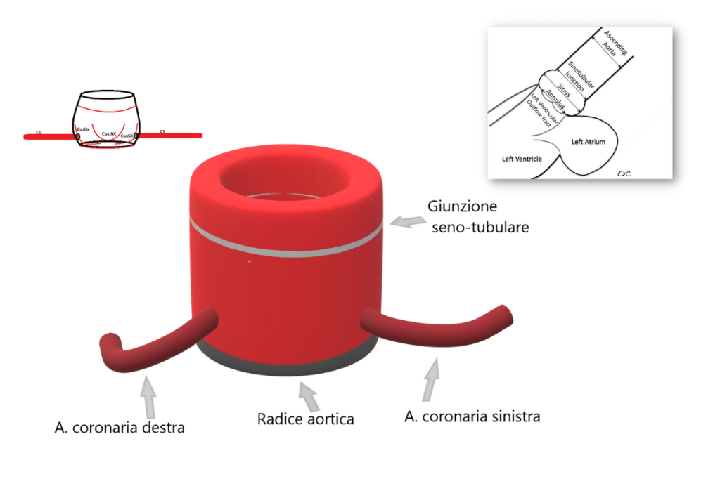 Ascending aorta.png di autore Ecgtocardiology CC BY SA 3.0 Wikimedia Commons Immagine di aorta 3D stilizzata e creata con strumenti di intelligenza artificiale modificata tramite Canva.com versione Pro