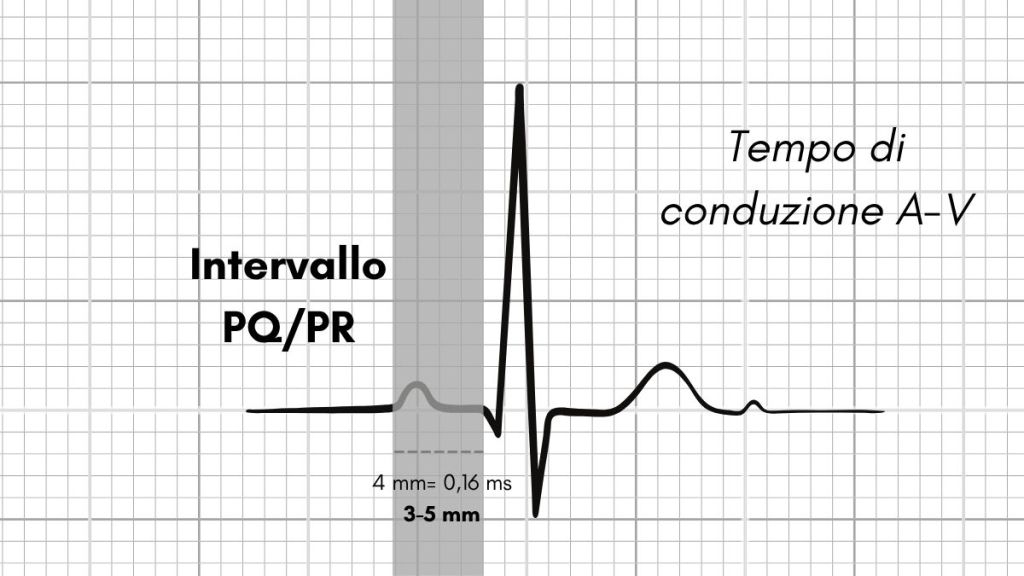 Intervallo PQ PR normale. Dario Tobruk ® realizzato con Canva.com Pro
