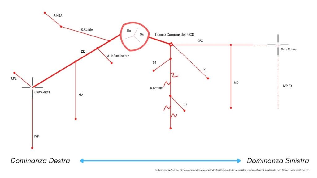 Schema sintetico del circolo coronarico e modelli di dominanza destro e sinistro. Dario Tobruk © realizzato con Canva.com versione Pro